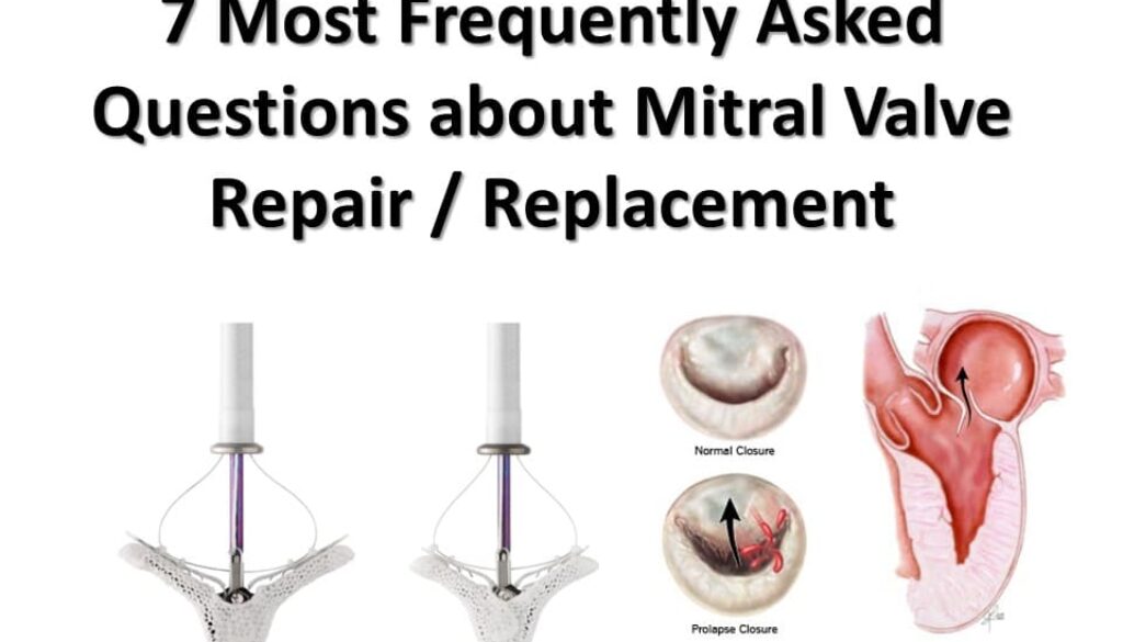mitral valve repair surgery cost in Hyderabad