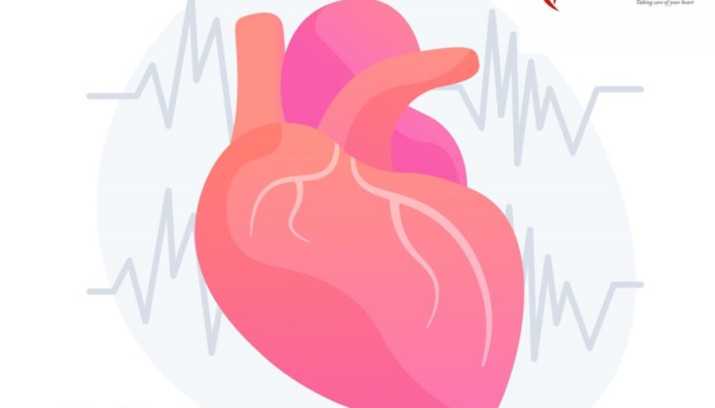 silent heart attack detection