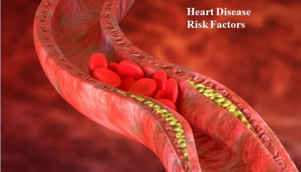 Risk factors for Heart Disease