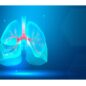 pulmonary vascular disease symptoms